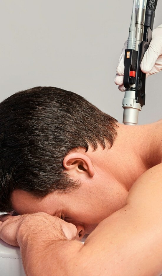 laser-hair-removal-men